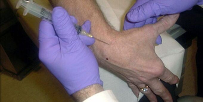piqûre pour douleur dans les articulations des doigts